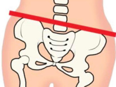 骨盤矯正/出張整体痛み改善筋膜リリース
