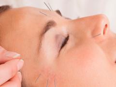 ★★★美容鍼　10% OFF★★★