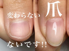 深爪・自爪育成専門ネイルサロン  モニター募集！！