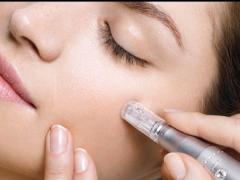 スキンニードリングモデル募集！