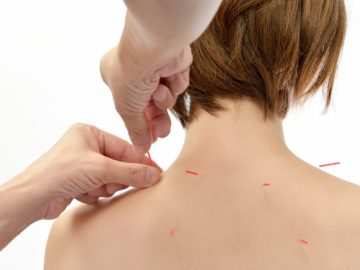 シドニー指圧クリニック／7月のキャンペーンは鍼強化！