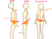 骨盤無料チェック