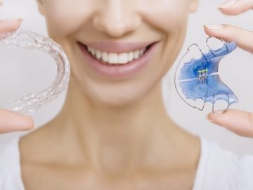 矯正治療後に使う「リテーナー」ってなに？