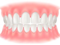 *すきっ歯（前歯の隙間）と滑舌・発音