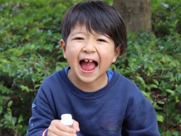 アジア人に多いすきっ歯や出っ歯は何が原因？