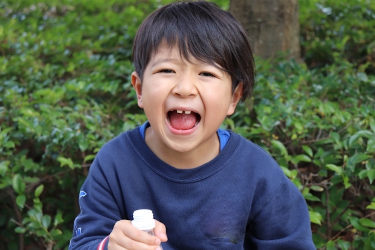アジア人に多いすきっ歯や出っ歯は何が原因？