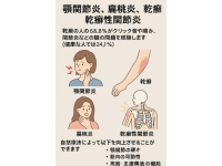 顎関節炎、扁桃炎、乾癬、そして乾癬性関節炎の驚くべき関連性！
