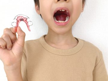 歯列矯正にかかる期間は？.